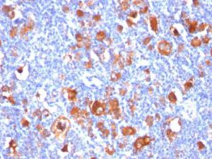 Anti-Fascin Mouse Monoclonal Antibody [clone: FSCN1/418]