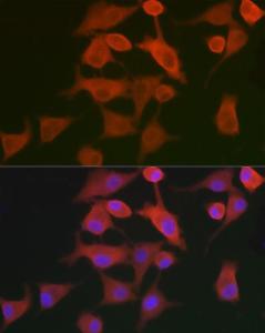 Immunofluorescence analysis of A-549 cells using Anti-AHNAK Antibody (A307240) at a dilution of 1:100. DAPI was used to stain the cell nuclei (blue)