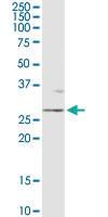 Anti-OTUB2 Rabbit Polyclonal Antibody