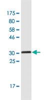 Anti-TMSB4Y Mouse Monoclonal Antibody [clone: 6G4]