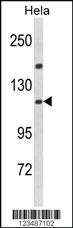 Anti-IPO11 Rabbit Polyclonal Antibody