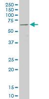 Anti-FOXC2 Mouse Monoclonal Antibody [clone: 4A5]