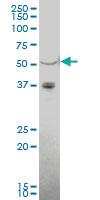 Anti-IGSF21 Mouse Polyclonal Antibody