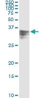 Anti-HPX Antibody Pair