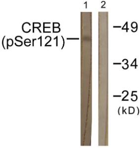 Antibody anti-CREB phospho SER121 100 µg