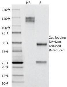 SDS-PAGE analysis of Anti-Cytokeratin 19 Antibody [A53-B/A2.26] under non-reduced and reduced conditions; showing intact IgG and intact heavy and light chains, respectively. SDS-PAGE analysis confirms the integrity and purity of the antibody