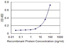 Anti-FOXC2 Mouse Monoclonal Antibody [clone: 4A5]