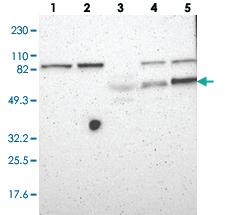 Anti-FBLN5 Rabbit Polyclonal Antibody