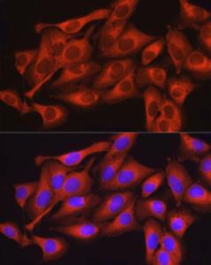 Immunofluorescence analysis of U2OS cells using Anti-Dynamin 2 Antibody (A12643) at a dilution of 1:150. DAPI was used to stain the cell nuclei (blue)