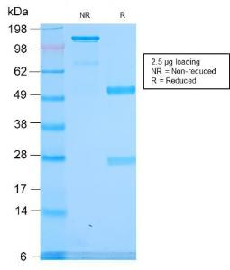 SDS-PAGE analysis of Anti-alpha 1 Spectrin Antibody [SPTA1/2939R] under non-reduced and reduced conditions; showing intact IgG and intact heavy and light chains, respectively. SDS-PAGE analysis confirms the integrity and purity of the antibody.