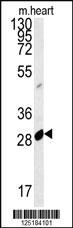 Anti-APOBEC2 Rabbit Polyclonal Antibody