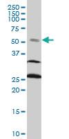 Anti-FOXC2 Mouse Monoclonal Antibody [clone: 4A3]