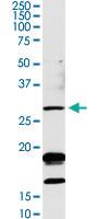 Anti-OTUB2 Rabbit Polyclonal Antibody