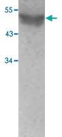 Anti-ESR2 Rabbit Polyclonal Antibody