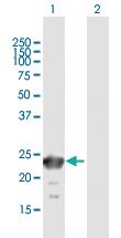 Anti-SSX6 Mouse Polyclonal Antibody