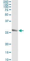 Anti-TWIST1 Antibody Pair