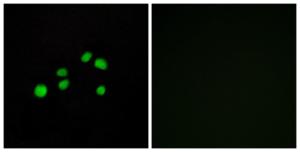 Anti-COL23A1 Rabbit Polyclonal Antibody