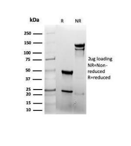 SDS-PAGE analysis of Anti-EGFR Antibody [rEGFR/6389] under non-reduced and reduced conditions; showing intact IgG and intact heavy and light chains, respectively SDS-PAGE analysis confirms the integrity and purity of the antibody