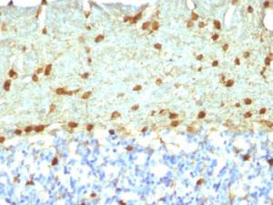 Anti-Fascin Mouse Monoclonal Antibody [clone: FSCN1/418]