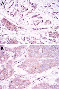 Anti-BECN1 Mouse Monoclonal Antibody [clone: 2A4]