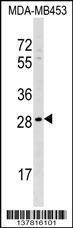 Anti-AIDA Rabbit Polyclonal Antibody (FITC (Fluorescein Isothiocyanate))