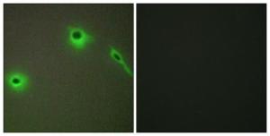 Anti-Endostatin Rabbit Polyclonal Antibody