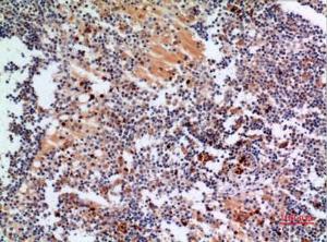 Immunohistochemical analysis of paraffin-embedded human lymph gland using Anti-CYBB Antibody