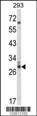 Anti-CDC42EP3 Rabbit Polyclonal Antibody