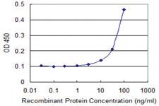 Anti-FOXC2 Mouse Monoclonal Antibody [clone: 4A3]