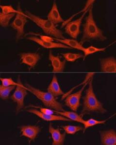 Immunofluorescence analysis of NIH/3T3 cells using Anti-Dynamin 2 Antibody (A12643) at a dilution of 1:150. DAPI was used to stain the cell nuclei (blue)