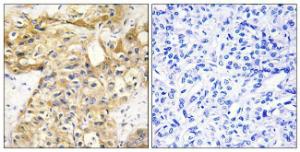 Anti-Endostatin Rabbit Polyclonal Antibody