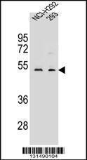 Anti-WDR86 Rabbit Polyclonal Antibody