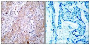 Anti-EGFR Rabbit Polyclonal Antibody