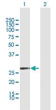 Anti-KLK2 Rabbit Polyclonal Antibody