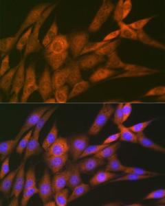 Immunofluorescence analysis of NIH-3T3 cells using Anti-14-3-3 Theta/Tau Antibody [ARC1358] (A307244) at a dilution of 1:100 (40X lens). DAPI was used to stain the cell nuclei (blue)