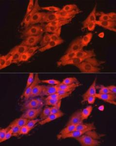 Immunofluorescence analysis of PC-12 cells using Anti-Dynamin 2 Antibody (A12643) at a dilution of 1:150. DAPI was used to stain the cell nuclei (blue)