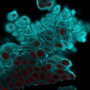 Immunofluorescent analysis of MCF-7 cells stained with Anti-Cytokeratin 19 Antibody [A53-B/A2.26] followed by Goat Anti-Mouse IgG (CF&#174; 488) (Cyan). Nuclei are stained with RedDot