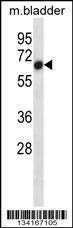 Anti-ACVR1 Rabbit Polyclonal Antibody (APC (Allophycocyanin))