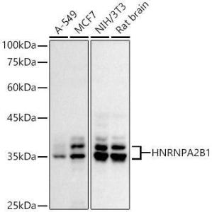 Western blot analysis of extracts of various cell lines, using Anti-hnRNP A2B1 Antibody (A307245) at 1:500 dilution. The secondary Antibody was Goat Anti-Rabbit IgG H&L Antibody (HRP) at 1:10000 dilution. Lysates/proteins were present at 25 µg per lane