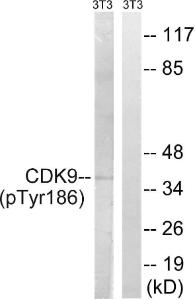 Western blot analysis of lysates from NIH/3T3 cells treated with Forskolin 40nM 30' using Anti-CDK9 (phospho Thr186) Antibody. The right hand lane represents a negative control, where the antibody is blocked by the immunising peptide