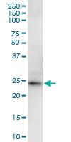 Anti-KLK2 Rabbit Polyclonal Antibody