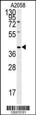 Anti-CD99L2 Rabbit Polyclonal Antibody (AP (Alkaline Phosphatase))