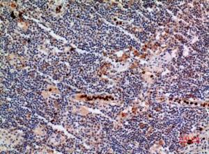 Immunohistochemical analysis of paraffin-embedded human lymph gland using Anti-CYBB Antibody