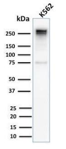 Western blot analysis of human K562 cell lysate using Anti-alpha 1 Spectrin Antibody [SPTA1/2939R]