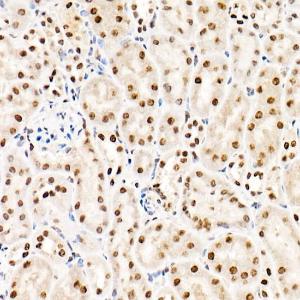 Immunohistochemistry analysis of paraffin-embedded mouse kidney using Anti-hnRNP A2B1 Antibody (A307245) at a dilution of 1:20 (40X lens). Perform high pressure antigen retrieval with 10 mM citrate buffer pH 6.0 before commencing with IHC staining protocol