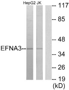 Western blot analysis of lysates from HepG2 and Jurkat cells using Anti-EFNA3 Antibody. The right hand lane represents a negative control, where the Antibody is blocked by the immunising peptide