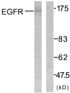 Anti-EGFR Rabbit Polyclonal Antibody