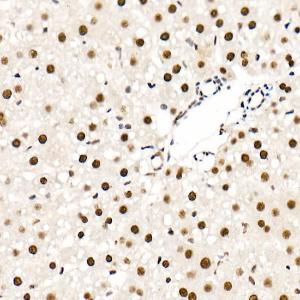 Immunohistochemistry analysis of paraffin-embedded rat liver using Anti-hnRNP A2B1 Antibody (A307245) at a dilution of 1:20 (40X lens). Perform high pressure antigen retrieval with 10 mM citrate buffer pH 6.0 before commencing with IHC staining protocol