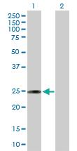 Anti-KLK2 Rabbit Polyclonal Antibody