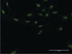 Anti-AIPL1 Mouse Monoclonal Antibody [clone: 1E1]